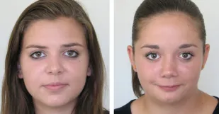 Policia Patra Lucia Nikoleta Hermanova