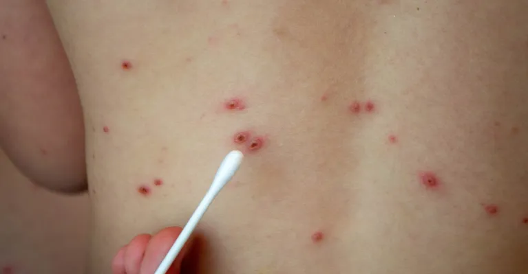 ilustračné foto 123rf.com / milastokerpro