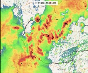 Radar